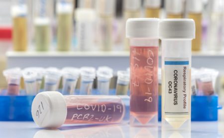 Celularity Expands Strategic Collaboration with United Therapeutics Corporation to COVID-19 Infection and Acute Respiratory Distress Syndrome